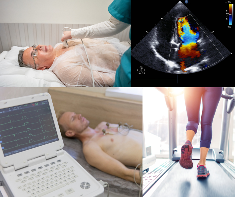 Cardiologista- exames complementares cardiológicos
