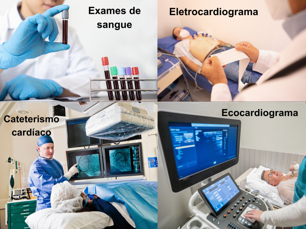 Ataque Cardíaco, Dor no peito, Infarto, Pontada no coração, Exames complementares para o Ataque Cardíaco